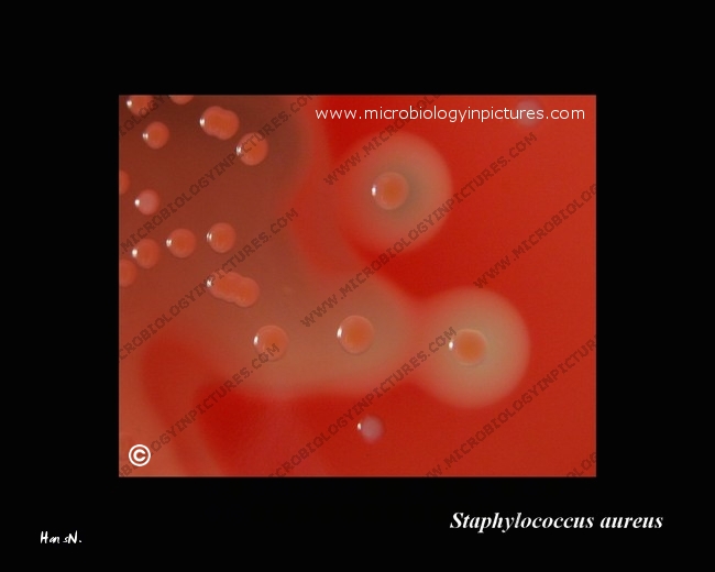 s.aureus beta-hemolysis
